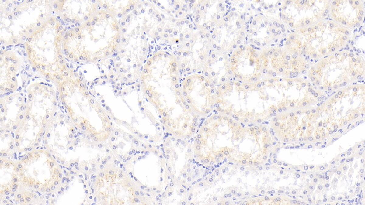 S100A3 Antibody (C5)
