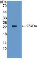 Supervillin Antibody (3-2#)