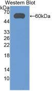 ALDH7A1 Antibody (7#)