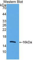 UCP2 Antibody (C1)