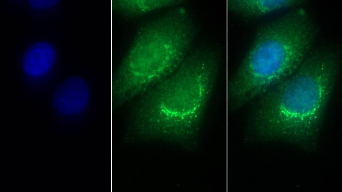 PSAP Antibody (D12)