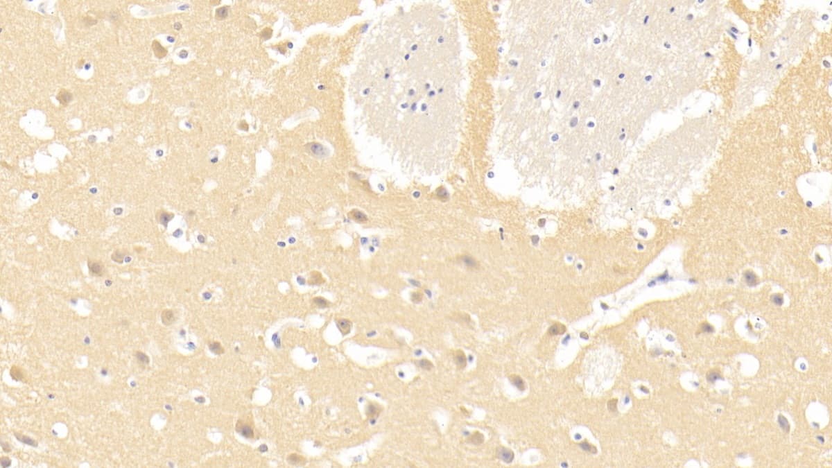 Laminin alpha 3 Antibody (C3)