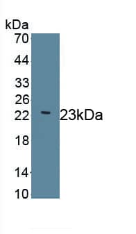 LAMC2 Antibody (D7)