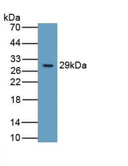 Integrin beta 6 Antibody (C5)