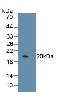 Collagen VIII alpha 1 Antibody (C3)