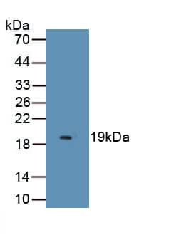 Endocan/ESM-1 Antibody (C7)