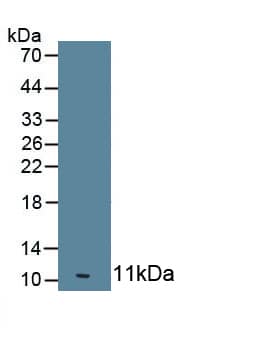 OAS1 Antibody (C5)