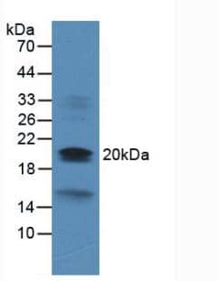 VHR/DUSP3 Antibody (2#)