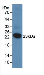 VHR/DUSP3 Antibody (2#)