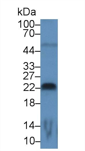 FGF-13 Antibody (C1)
