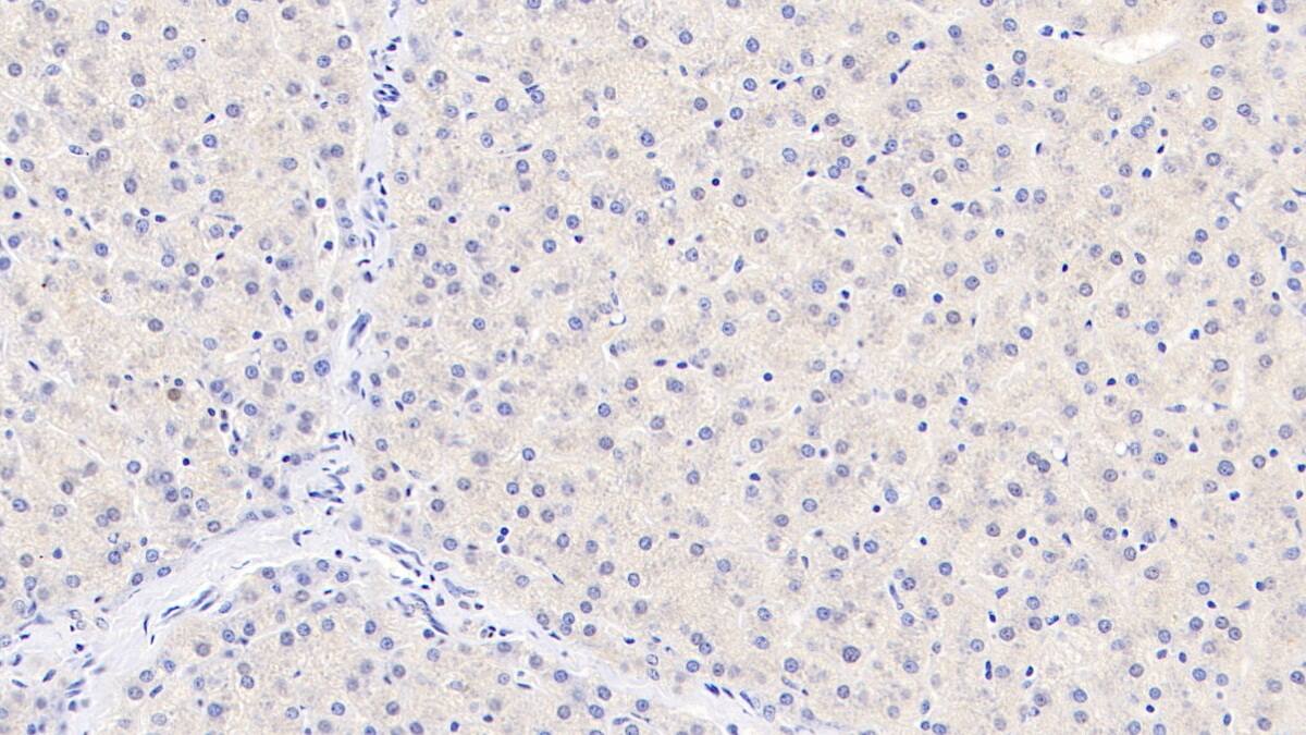 TDO2 Antibody (C1)