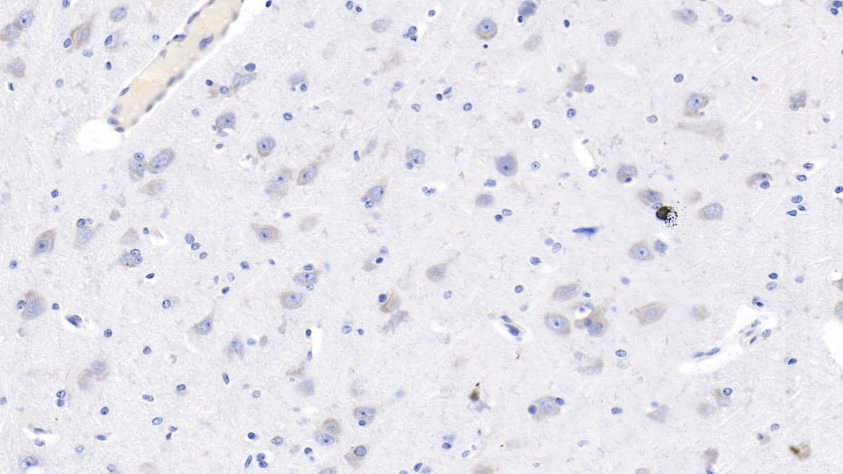 NMDA R, NR2B Subunit Antibody (C4)