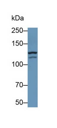 NMDAR2D Antibody (D4)