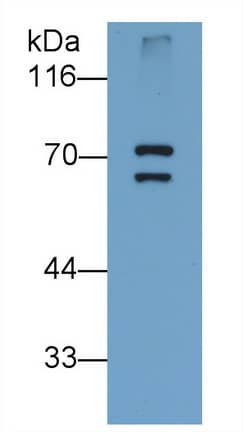 PADI6 Antibody (D2)