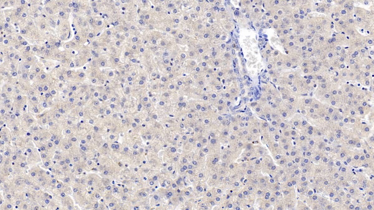 MAPRE1 Antibody (C1)