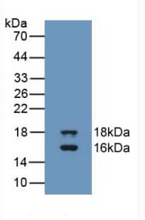 GDF-3 Antibody (A7)