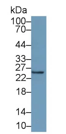 IFN-alpha F/IFNA21 Antibody (D4)