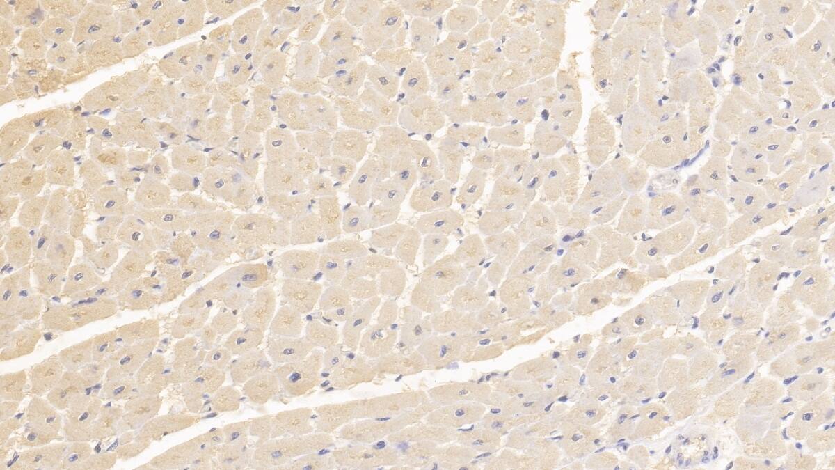 TTC11 Antibody (C1)