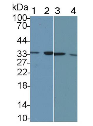 Calponin 2 Antibody (C7)