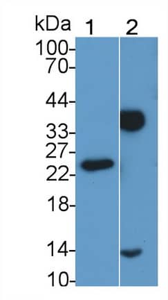 C1qTNF1/CTRP1 Antibody (C2)