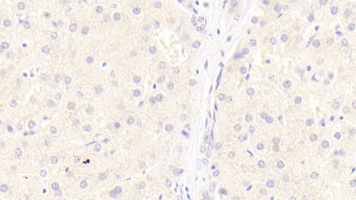 LRP-6 Antibody (C3)