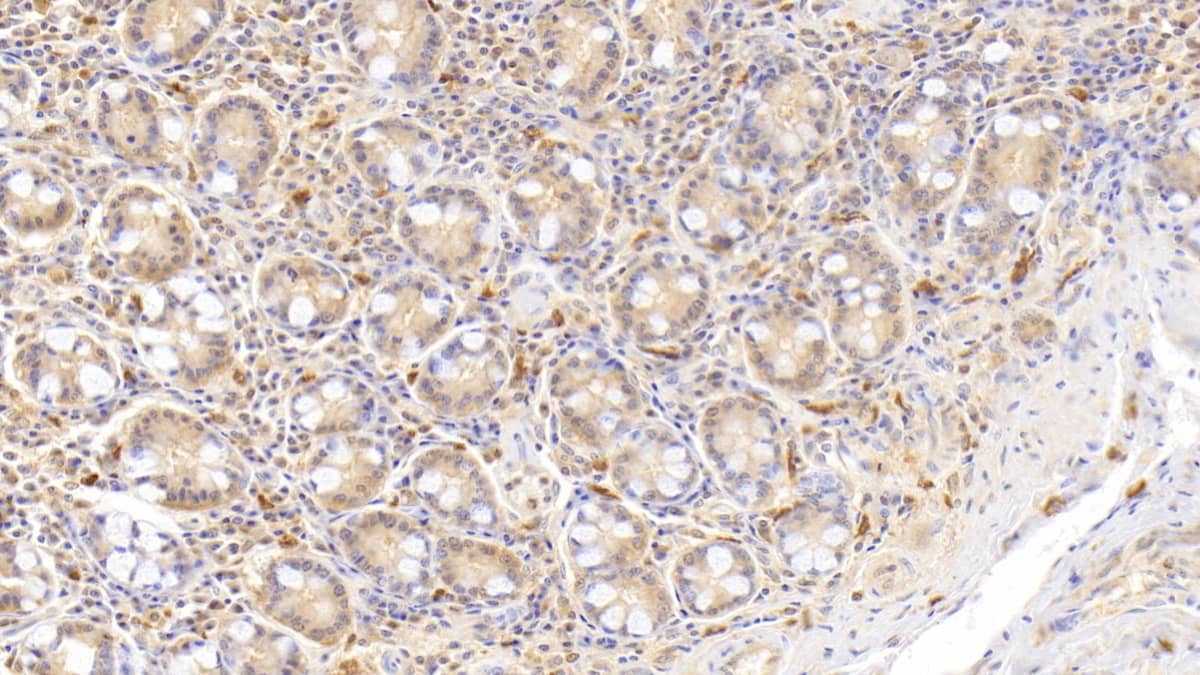 Eosinophil derived neurotoxin Antibody (C13)