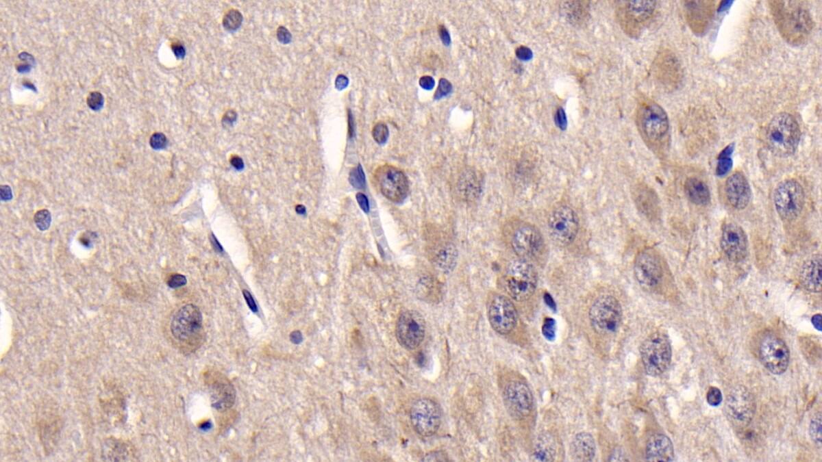 Casein Kinase 1 delta Antibody (C3)