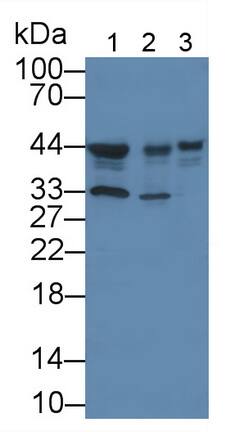 Casein Kinase 1 delta Antibody (C3)