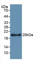 Apolipoprotein L2 Antibody (C1)