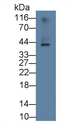 Apolipoprotein L2 Antibody (C1)