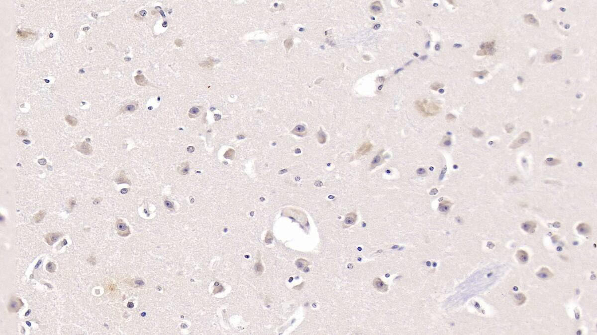 Apolipoprotein L2 Antibody (C1)