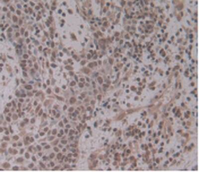 ENPP-2/Autotaxin Antibody (A4)