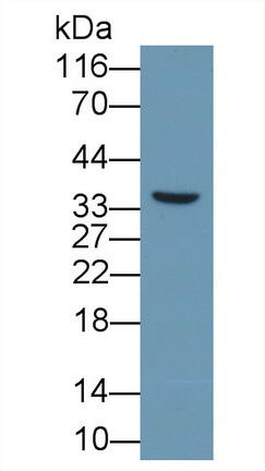 ENPP-2/Autotaxin Antibody (A4)