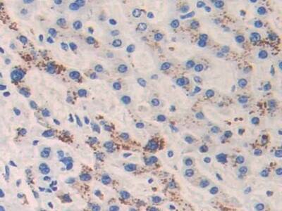 CAMP/Cathelicidin Antibody (C1)