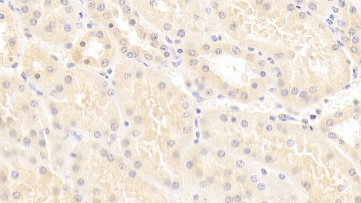epithelial Sodium Channel gamma Antibody (C1)