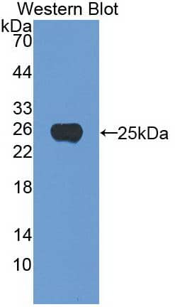 Noggin Antibody (A7)