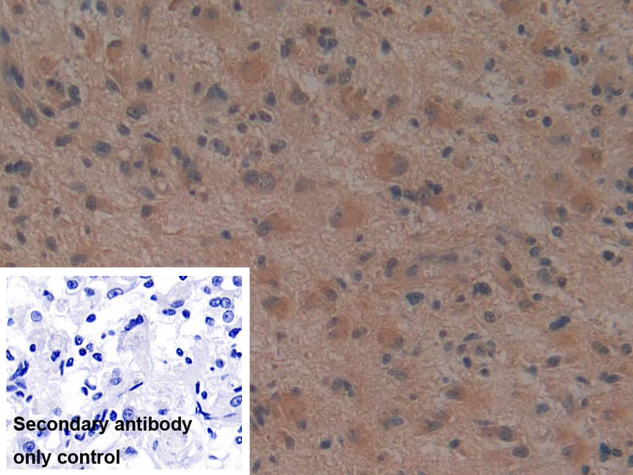 Noggin Antibody (A7)