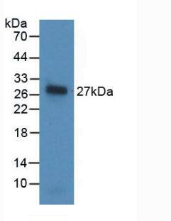 Noggin Antibody (A11)