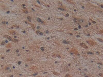 Noggin Antibody (A9)