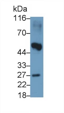 Noggin Antibody (A9)