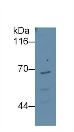 Ferroportin/SLC40A1 Antibody (C11)