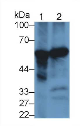 Phenylalanine Hydroxylase Antibody (C3)