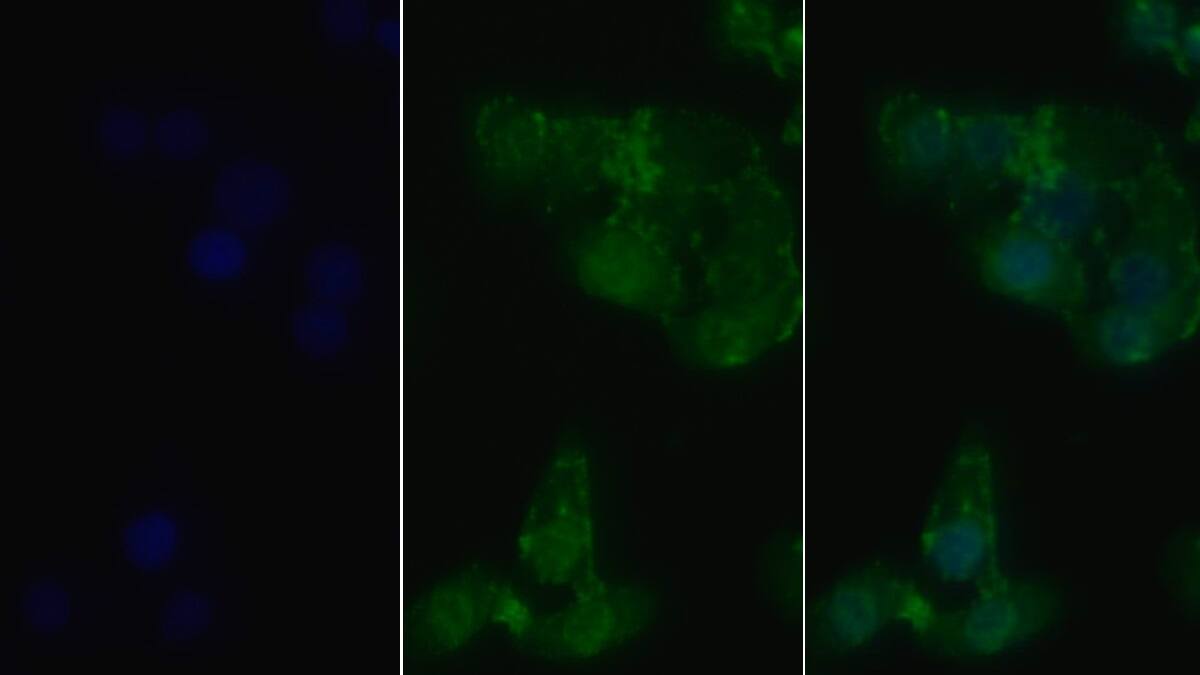 RIPK1/RIP1 Antibody (C1)