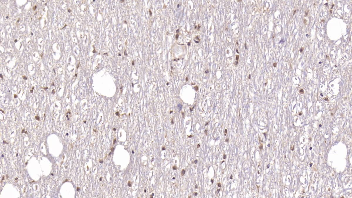 DCLK1 Antibody (C8)