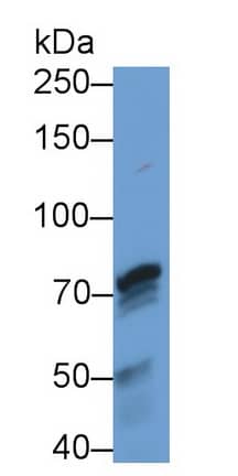 PADI4 Antibody (C5)