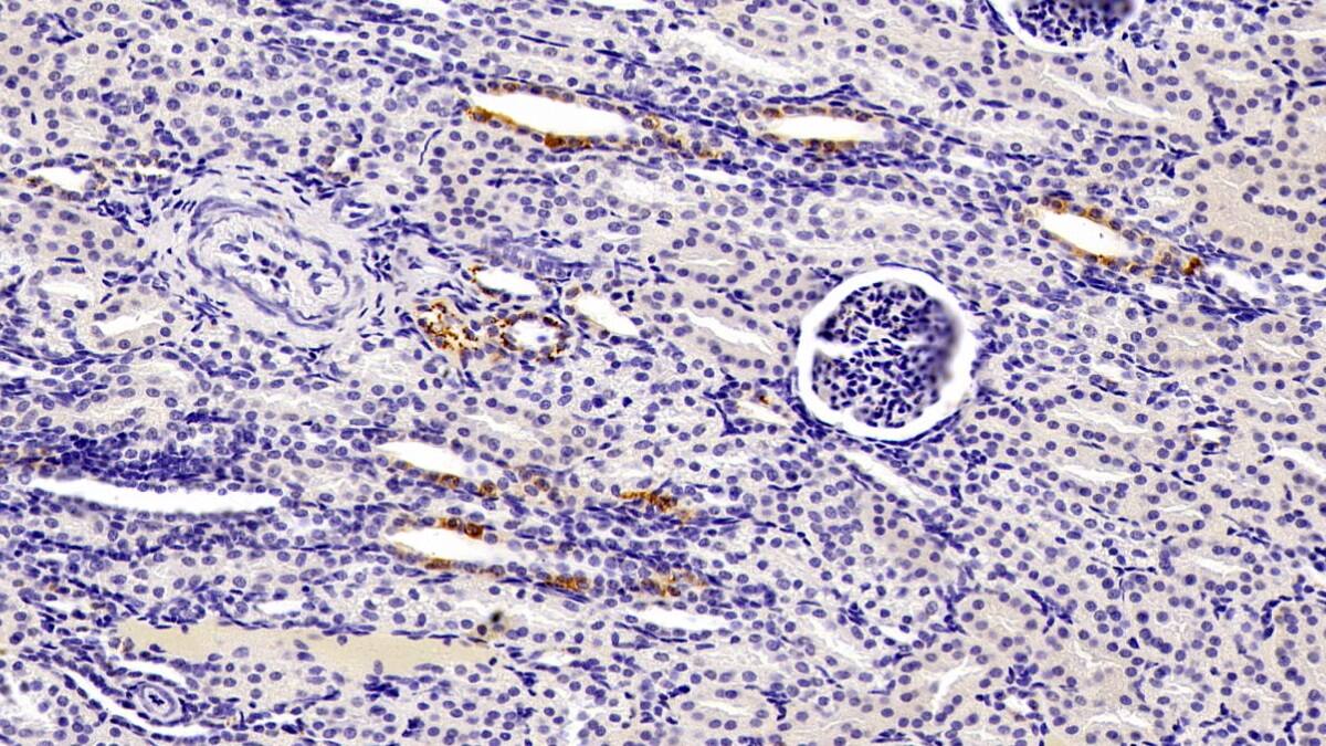 SeP Antibody (H1)