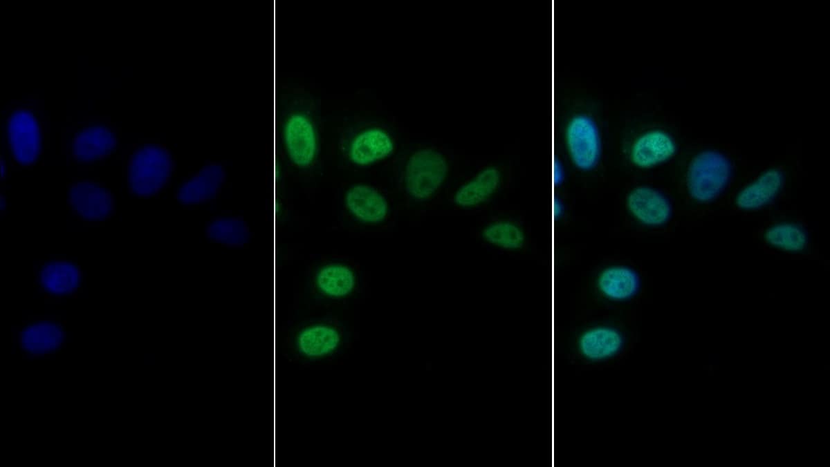 CEBP alpha Antibody (C9)