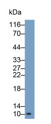 S100A/B Antibody (C6)