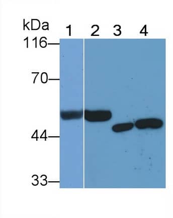 Heparanase/HPSE Antibody (C5)