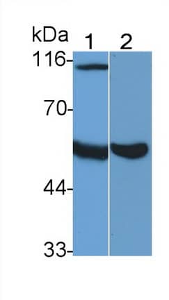 Heparanase/HPSE Antibody (C6)